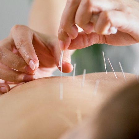 Acupuncteur